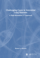 Challenging Cases in Interstitial Lung Diseases: A High-Resolution CT Approach 1032950056 Book Cover
