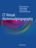 CT Virtual Hysterosalpingography 3319075594 Book Cover