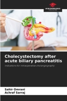 Cholecystectomy after acute biliary pancreatitis 6208208475 Book Cover