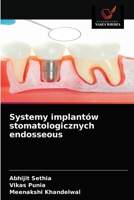 Systemy implantów stomatologicznych endosseous 6203507490 Book Cover
