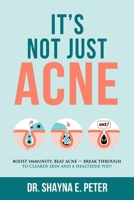 It's Not Just Acne: Boost Immunity, Beat Acne - Break Through to Clearer Skin & A Healthier You! 1735465704 Book Cover