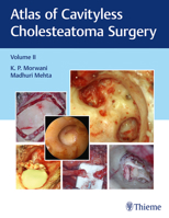 Atlas of Cavityless Cholesteatoma Surgery, Vol 2 9388257197 Book Cover