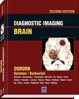 Diagnostic Imaging: Brain 0721629059 Book Cover