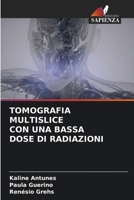 Tomografia Multislice Con Una Bassa Dose Di Radiazioni (Italian Edition) 6207516850 Book Cover