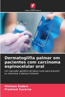 Dermatoglifia palmar em pacientes com carcinoma espinocelular oral (Portuguese Edition) 6203581267 Book Cover