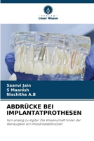 Abdrücke Bei Implantatprothesen (German Edition) 6630270533 Book Cover