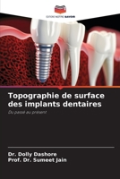 Topographie de surface des implants dentaires (French Edition) 6209459153 Book Cover