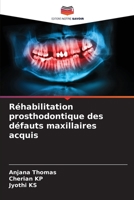 Réhabilitation prosthodontique des défauts maxillaires acquis 6204154877 Book Cover