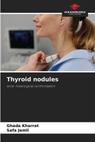 Thyroid nodules 6208112834 Book Cover