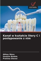 Kanal w ksztalcie litery C i postepowanie z nim (Polish Edition) 6630067991 Book Cover