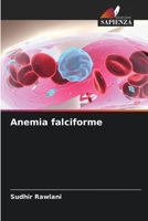 Anemia falciforme (Italian Edition) 6209614647 Book Cover