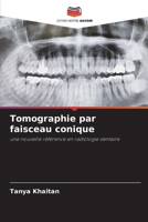 Tomographie par faisceau conique (French Edition) 6630179072 Book Cover