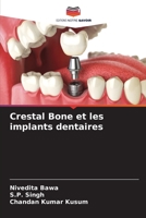 Crestal Bone et les implants dentaires 6205368935 Book Cover