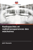 Radiopacités et radiotransparences des mâchoires (French Edition) 6209520650 Book Cover