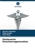 Gesteuerte Knochenregeneration 6205619504 Book Cover