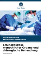 Echinokokkose menschlicher Organe und chirurgische Behandlung (German Edition) 6209736262 Book Cover