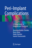 Peri-Implant Complications: A Clinical Guide to Diagnosis and Treatment 3030097013 Book Cover