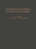 Technique of Internal Fixation of Fractures 3642883583 Book Cover