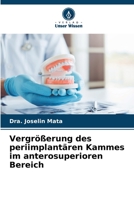 Vergrößerung des periimplantären Kammes im anterosuperioren Bereich 6206351890 Book Cover