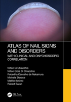 Atlas of Nail Signs and Disorders with Clinical and Onychoscopic Correlation 1032257903 Book Cover