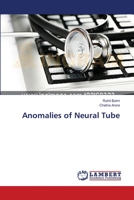 Anomalies of Neural Tube 365961937X Book Cover