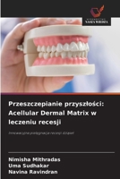 Przeszczepianie przyszlosci: Acellular Dermal Matrix w leczeniu recesji (Polish Edition) 620971739X Book Cover