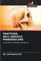 FRATTURA DELL'ANGOLO MANDIBOLARE: ANATOMIA E GESTIONE CHIRURGICA (Italian Edition) B0CJB9WV7L Book Cover