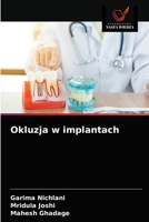 Okluzja w implantach 6203523526 Book Cover