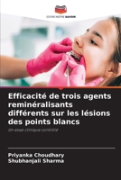 Efficacité de trois agents reminéralisants différents sur les lésions des points blancs: Un essai clinique contrôlé 6205645157 Book Cover