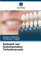 Ästhetik bei festsitzendem Teilzahnersatz (German Edition) 6209800882 Book Cover