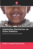 Implantes Dentários na Zona Estética 6205653893 Book Cover