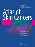Atlas of Skin Cancers: Practical Guide to Diagnosis and Treatment 3662501651 Book Cover