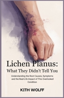 Lichen Planus: What They Didn’t Tell You: Understanding the Root Causes, Symptoms, and the Real-Life Impact of This Overlooked Condition B0FFH532W2 Book Cover
