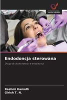 Endodoncja sterowana (Polish Edition) 6209303129 Book Cover