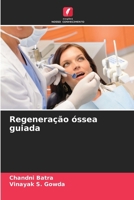 Regeneração óssea guiada (Portuguese Edition) 620390807X Book Cover