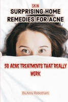 Skin: SURPRISING HOME REMEDIES FOR ACNE: 50 ACNE TREATMENTS THAT REALLY WORK, Natural Remedies To Cure Acne (Natural Cures, Skin Health, Skin, Natural Health) (Acne 1688431136 Book Cover