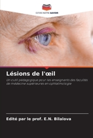 Lésions de l'œil: Un outil pédagogique pour les enseignants des facultés de médecine supérieures en ophtalmologie 6206105121 Book Cover
