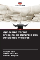 Lignocaïne versus articaine en chirurgie des troisièmes molaires (French Edition) 6209886655 Book Cover