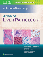 Atlas of Liver Pathology: A Pattern-Based Approach 1496396979 Book Cover