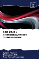CAD CAM в имплантационной стом 620714578X Book Cover