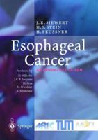 Esophageal Cancer 3540148728 Book Cover