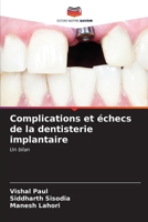 Complications et échecs de la dentisterie implantaire (French Edition) 6206907384 Book Cover