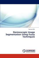 Dermoscopic Image Segmentation Using Fuzzy Techniques 384435512X Book Cover