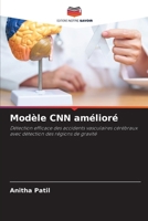 Modèle CNN amélioré: Détection efficace des accidents vasculaires cérébraux avec détection des régions de gravité (French Edition) 6208741521 Book Cover