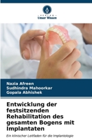 Entwicklung der festsitzenden Rehabilitation des gesamten Bogens mit Implantaten 620661543X Book Cover