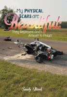 My Physical Scars Are Beautiful: They Represent God's Answer to Prayer 1449774342 Book Cover