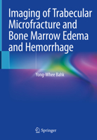 Imaging of Trabecular Microfracture and Bone Marrow Edema and Hemorrhage 9811544654 Book Cover