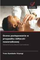 Ocena postepowania w przypadku zóltaczki noworodkowej (Polish Edition) 6630274687 Book Cover