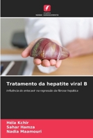 Tratamento da hepatite viral B (Portuguese Edition) 6209175546 Book Cover