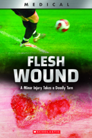 Flesh Wound (XBooks): A Minor Injury Takes a Deadly Turn 053113296X Book Cover
